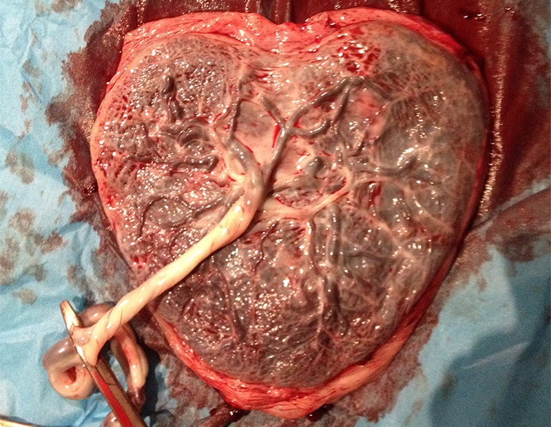 PLACENTA