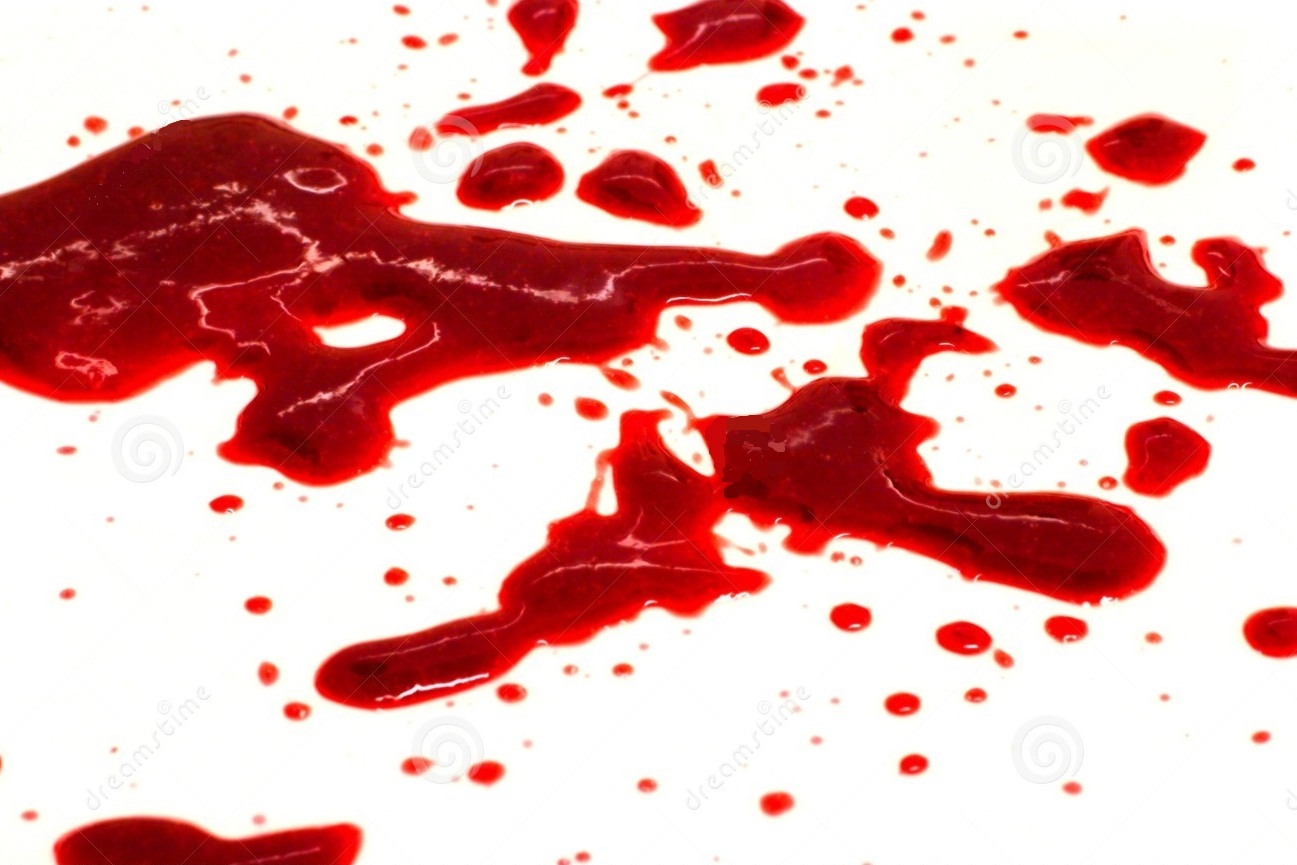 Que Significa Sonar Con Sangre Mi Sitio